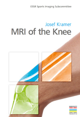 MRI of the Knee - 