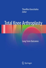 Total Knee Arthroplasty - 