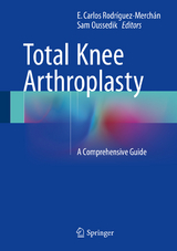 Total Knee Arthroplasty - 