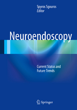 Neuroendoscopy - 