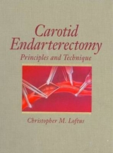 Carotid Endarterectomy - Loftus, Christopher M.