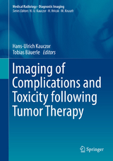 Imaging of Complications and Toxicity following Tumor Therapy - 