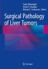 Surgical Pathology of Liver Tumors - 