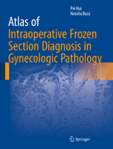 Atlas of Intraoperative Frozen Section Diagnosis in Gynecologic Pathology - Pei Hui, Natalia Buza