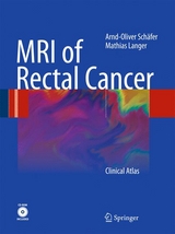 MRI of Rectal Cancer - Arnd-Oliver Schäfer, Mathias Langer