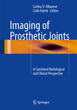 Imaging of Prosthetic Joints - 