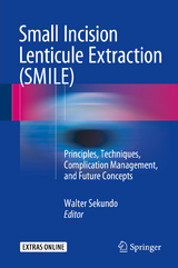 Small Incision Lenticule Extraction (SMILE) - 