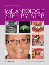 Implantologie Step by Step - Sliwowski, Christoph T.