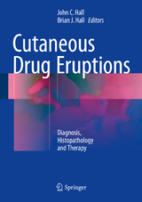 Cutaneous Drug Eruptions - 