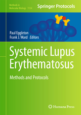 Systemic Lupus Erythematosus - 