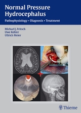 NPH - Normal Pressure Hydrocephalus - Michael J. Fritsch, Uwe Kehler, Ullrich Meier