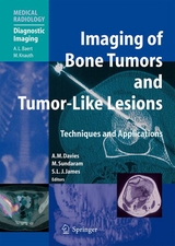 Imaging of Bone Tumors and Tumor-Like Lesions - 