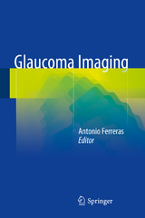 Glaucoma Imaging - 