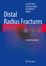 Distal Radius Fractures - 