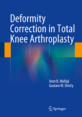 Deformity Correction in Total Knee Arthroplasty - Arun B. Mullaji, Gautam M. Shetty