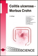 Colitis ulcerosa - Morbus Crohn - Eduard F. Stange