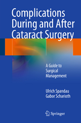 Complications During and After Cataract Surgery - Ulrich Spandau, Gabor Scharioth