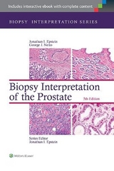 Biopsy Interpretation of the Prostate - Epstein, Jonathan I.; Netto, George J.