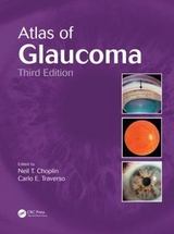 Atlas of Glaucoma - Choplin, Neil T.; Traverso, Carlo E.