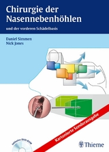 Chirurgie der Nasennebenhöhlen -  ORL-Zentrum Klinik Hirslanden, Nicholas S. Jones