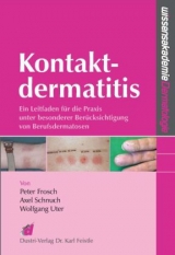 Kontaktdermatitis - Peter Frosch, Axel Schnuch, Wolfgang Uter