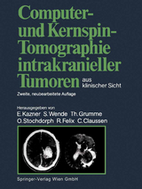 Computer- und Kernspin-Tomographie intrakranieller Tumoren aus klinischer Sicht - Kazner, Ekkehard; Wende, Sigurd; Grumme, Thomas; Stochdorph, Otto; Felix, Roland; Claussen, Claus