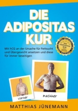 Die Adipositas-Kur - Matthias Jünemann