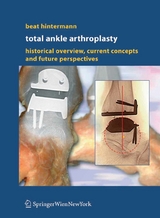 Total Ankle Arthroplasty - Beat Hintermann