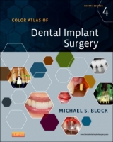 Color Atlas of Dental Implant Surgery - Block, Michael S.