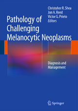 Pathology of Challenging Melanocytic Neoplasms - 