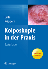 Kolposkopie in der Praxis - Ralph J. Lellé, Volkmar Küppers