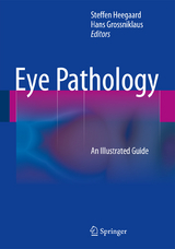 Eye Pathology - 