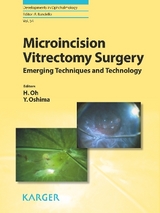 Microincision Vitrectomy Surgery - 