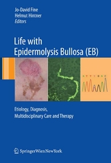 Life with Epidermolysis Bullosa (EB) - 