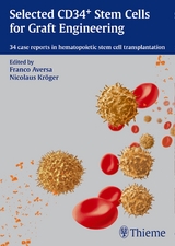 Selected CD34+ Stem Cells for Graft Engineering - Nicolaus Kröger