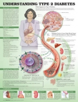 Understanding Type 2 Diabetes Anatomical Chart - Anatomical Chart Company; Unger, Jeff