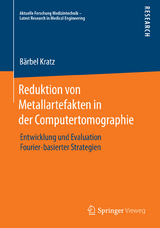 Reduktion von Metallartefakten in der Computertomographie - Bärbel Kratz