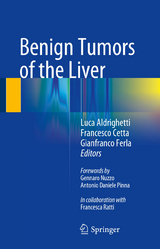 Benign Tumors of the Liver - 