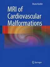 MRI of Cardiovascular Malformations - Bruno Kastler