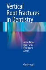 Vertical Root Fractures in Dentistry - 