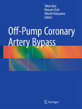 Off-Pump Coronary Artery Bypass - 