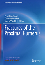 Fractures of the Proximal Humerus - 