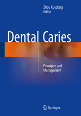 Dental Caries - 