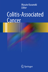 Colitis-Associated Cancer - 