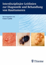 Interdisziplinäre Leitlinien zur Diagnostik und Behandlung von Hauttumoren -  Claus Garbe,  Holger Reimann