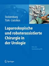 Laparoskopische und roboterassistierte Chirurgie in der Urologie - 