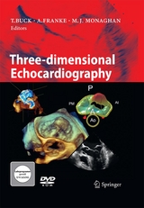 Three-dimensional Echocardiography - 