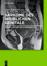 Sarkome des weiblichen Genitale - Günther Köhler, Matthias Evert, Katja Evert, Marek Zygmunt