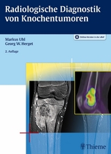 Radiologische Diagnostik von Knochentumoren - 