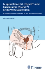 Leuprorelinacetat (Eligard®) und Enzalutamid (Xtandi) beim Prostatakarzinom - Axel S. Merseburger